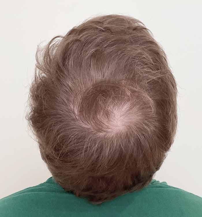 Male, 32, before