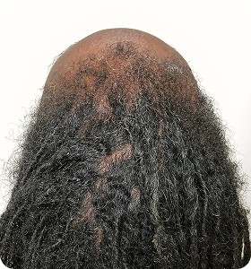 Female, 43, after