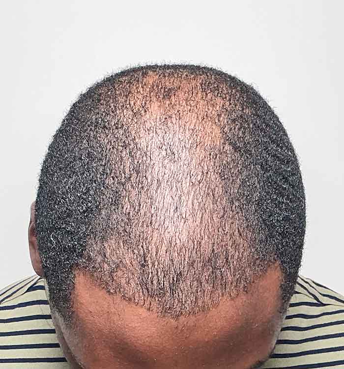 Male, 35, before