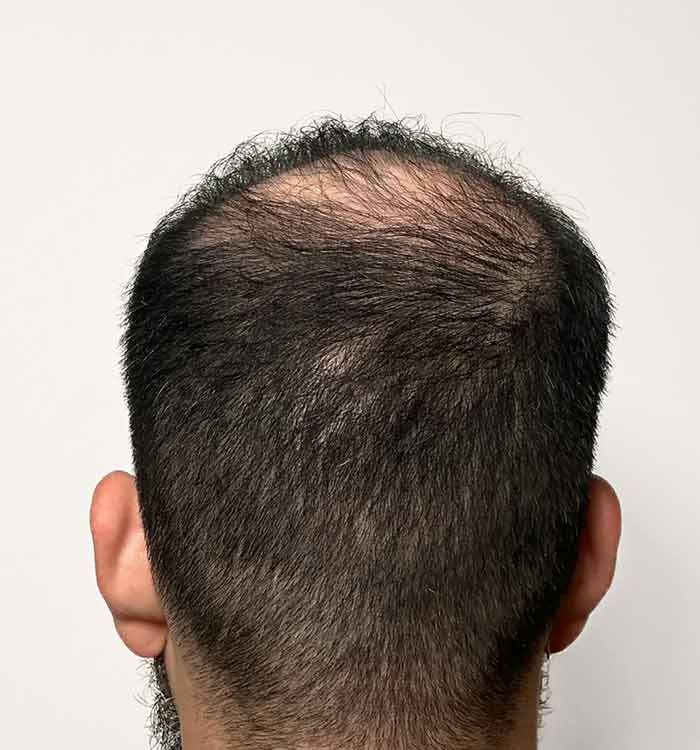 Male, 37, after