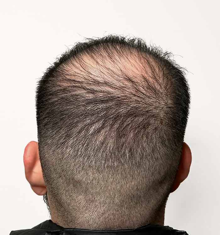 Male, 37, before