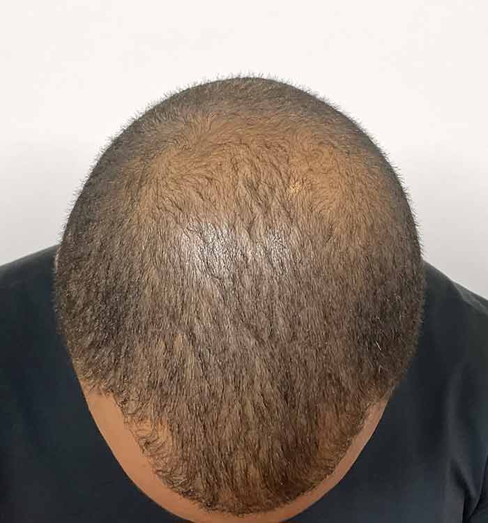 Male, 38, before