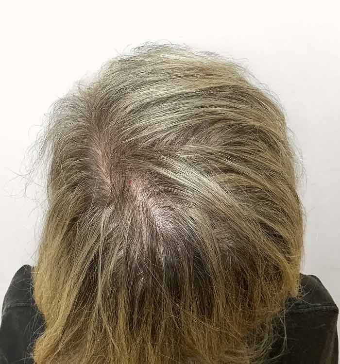 Female, 44, after