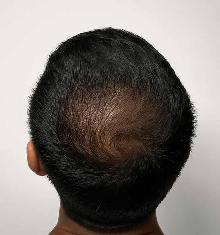 Male, 31, after
