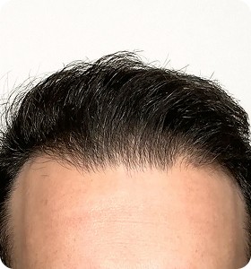 Male, 29, after
