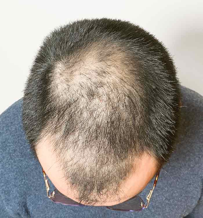 Male, 30, before
