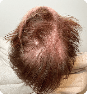 Female, 52, before